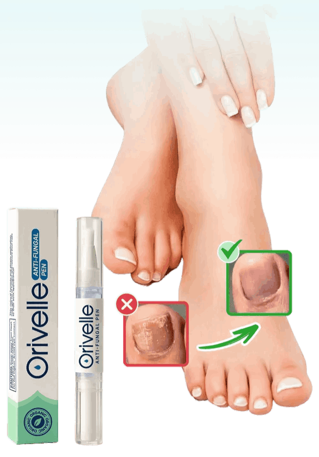 Orivelle Nail Fungus Pen – Official Site – Oriville